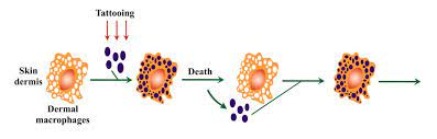 pigment stays in the skin after the macrophages die