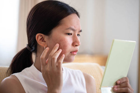 Woman with acne looking at herself in the mirror and touching her cheek