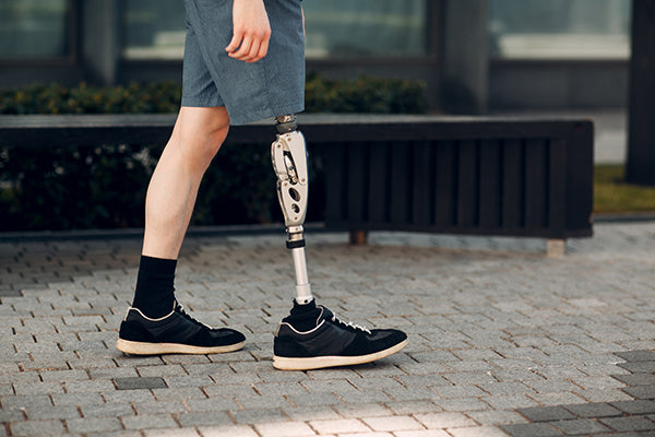 Man with limb loss walking.