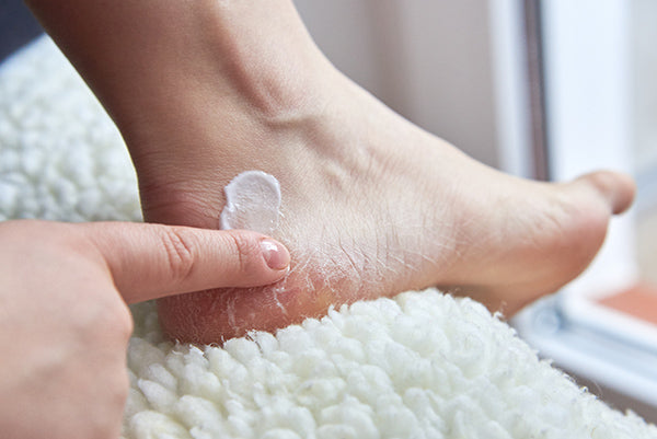 Applying moisturizer to foot