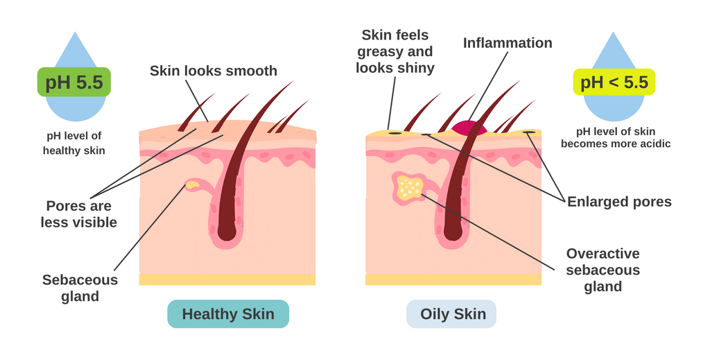 Oily Skin