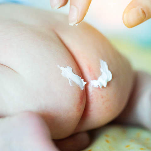 Close up of adult applying baby lotion to baby's bottom rash