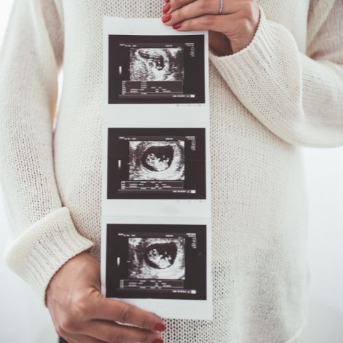 pregnant mom in white sweater holding set of 3 ultrasound images