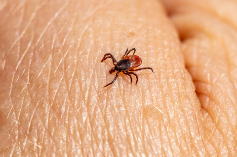 Tick Climbing on Skin