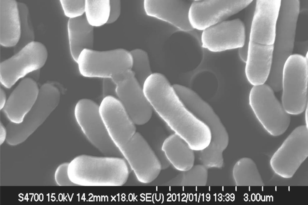 腸内細菌のエサとなる植物性乳酸菌を1500億個も含有する「ANP71」