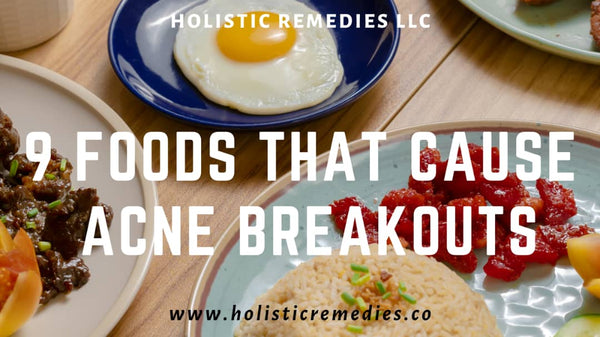 the foods that cause or increase risk of acne 