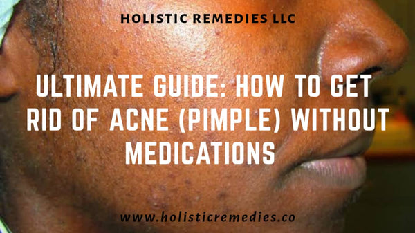 get rid of acne without mediations or delay 