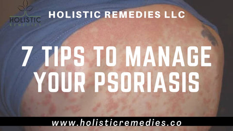 7 tips to manage your psoriasis