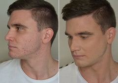 Mens Makeup Before And After medium