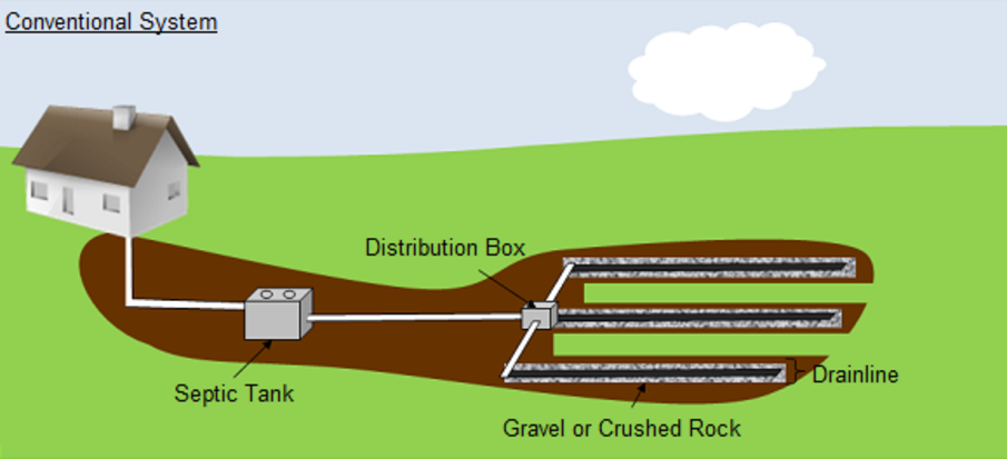 Septic tank filter system