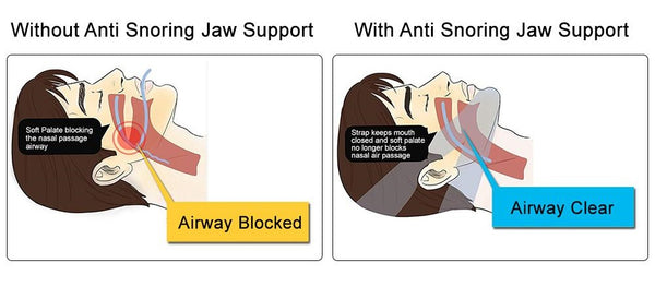 Anti Snore Stop Snoring Chin Strap Device Solution Anti Apnea Sleep Support Sleeping Care