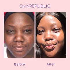 SKIN REPUBLIC COLLAGEN INFUSION FACE MASK CHALLENGE - BEFORE & AFTER