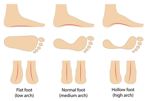 Neutral arch foot - Touchy Style