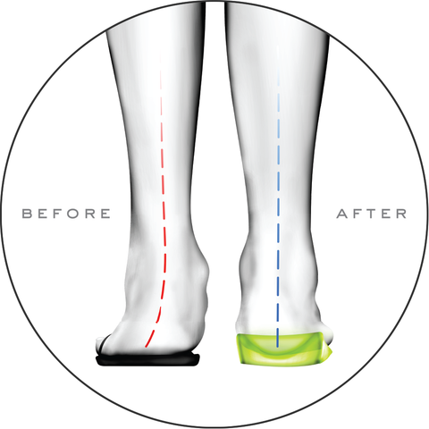 vionic orthotic insoles