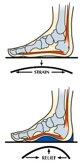 Foot Conditions – Sole Integrity