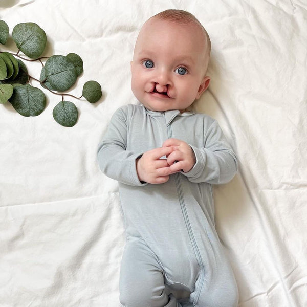 Adorable baby with cleft lip on m in Gray kyte BABY pajamas