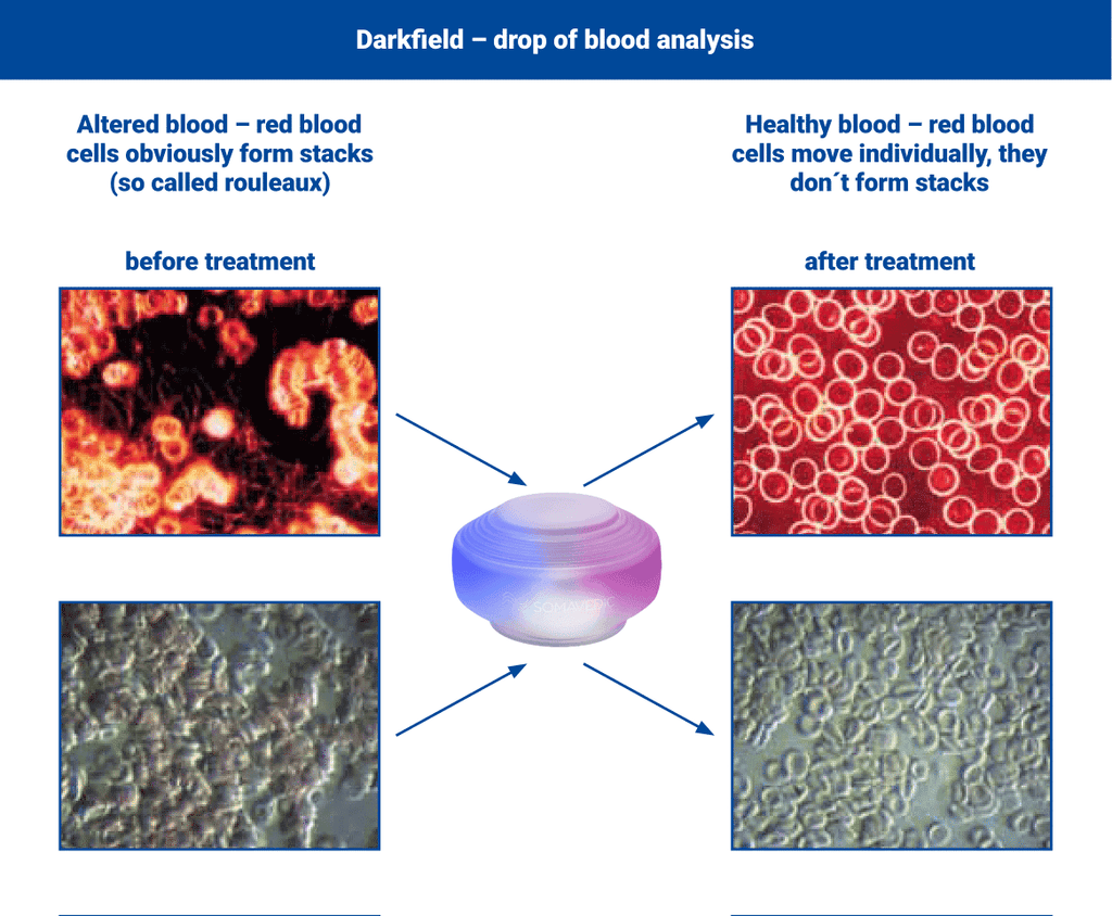 Blood cells before and after structured water