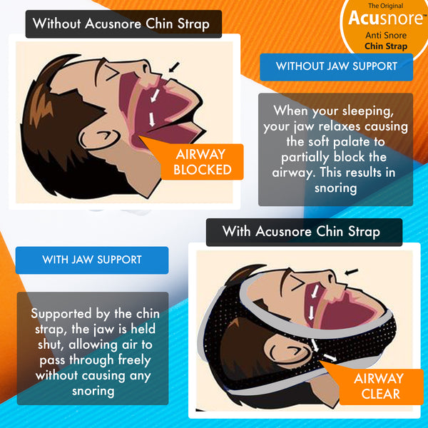 Acusnore Anti Snore Chin Strap 2