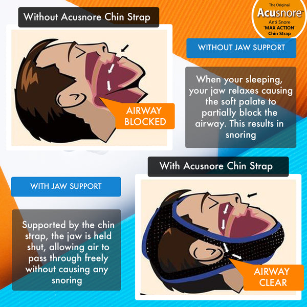 Acusnore Anti Snore Double Support Max Action Chin Strap 5