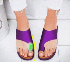 "Exemple-d'utilisation-des-sandales-correctrices-Hallux-Valgus-pour-un-confort-de-pied-amélioré-et-une-meilleure-posture-de-la-marche"