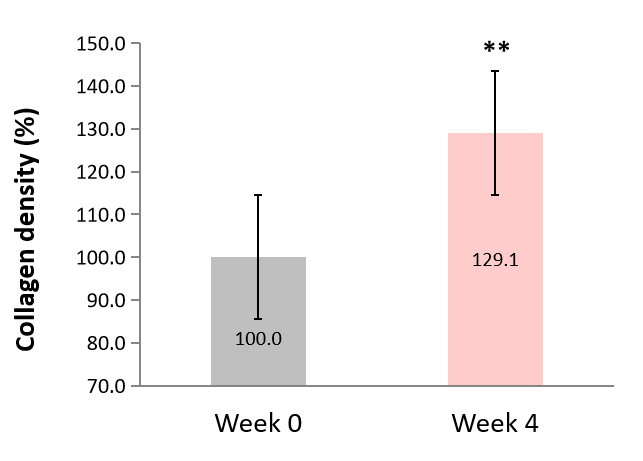 Collagen density