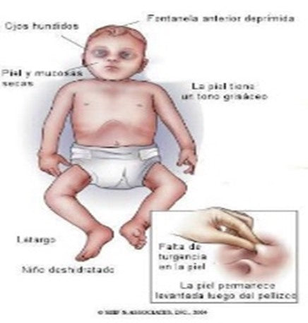recien nacido datos de alarma alerta cuidado nacimiento enfermedad maternidad pediatría 