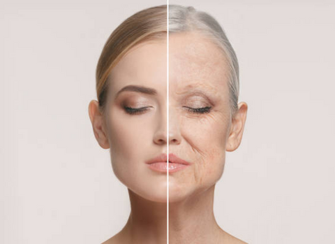 Skin ageing 