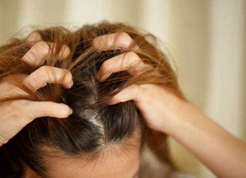 Prevent scalp issues 