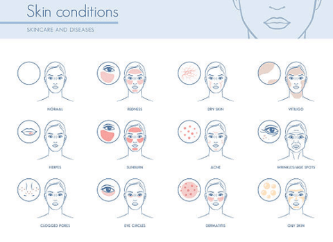 Skin conditions