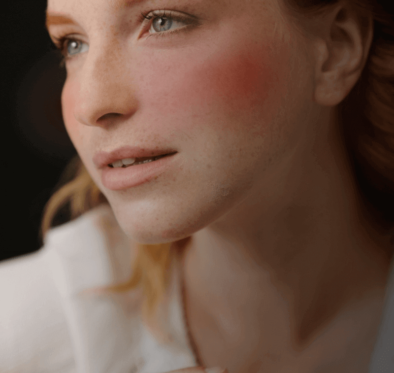 Why are cheeks red – Finca Skin