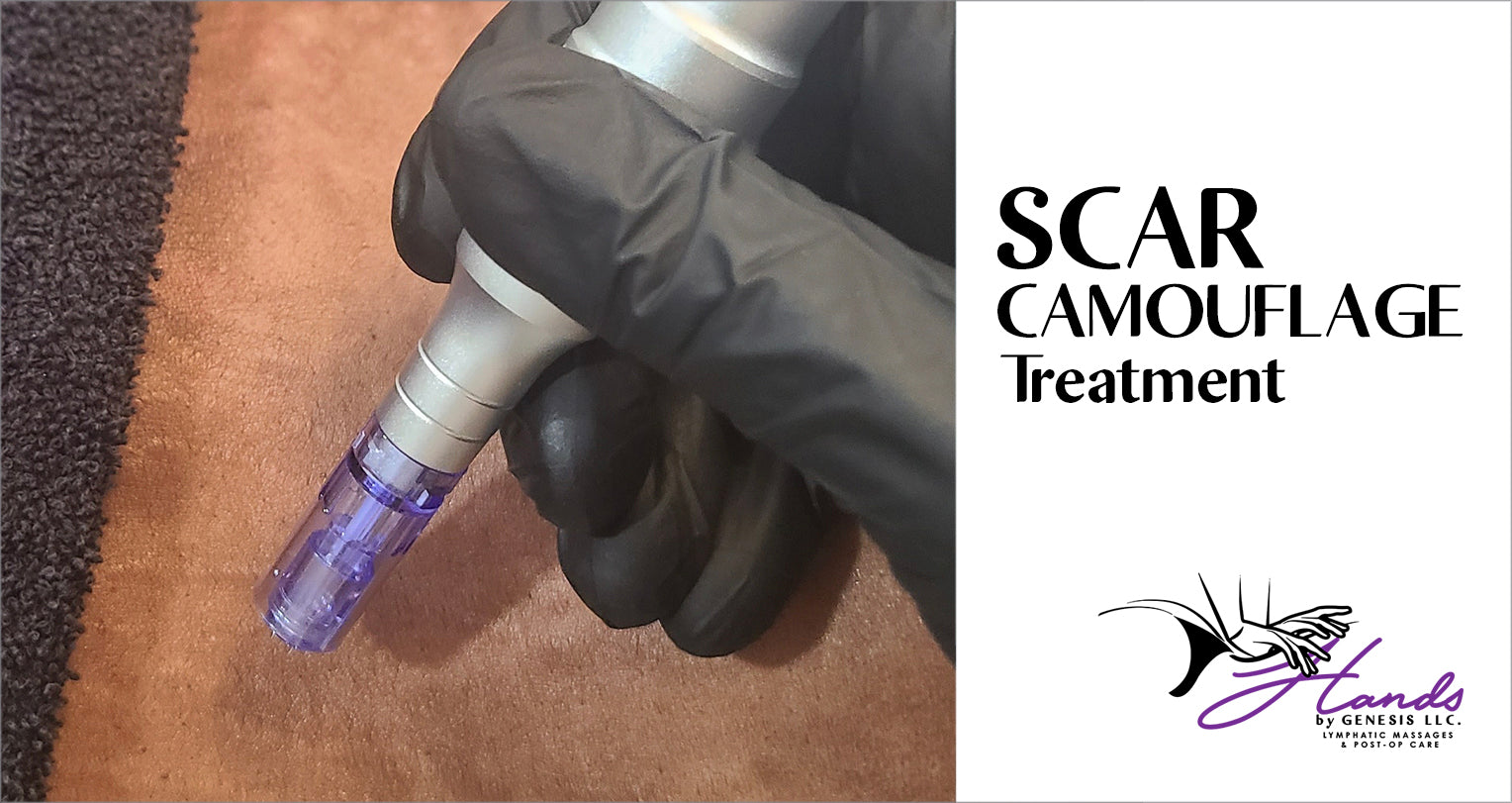 Scar camouflage treatment Brooklyn NY - Hands by Genesis