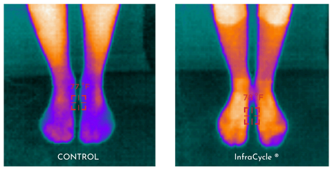 Infrared Imaging comparing socks, control versus InfraCycle®, showing the improved circulation with InfraCycle®. 