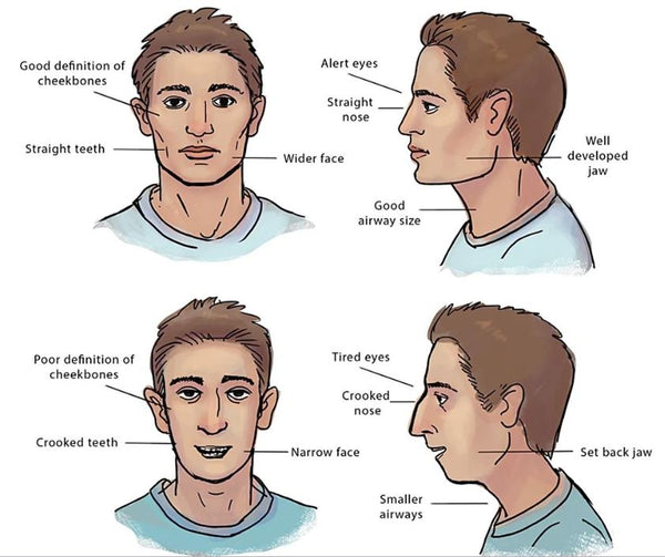 Les appareils pour entraîner sa mâchoire – MusclerSonVisage®