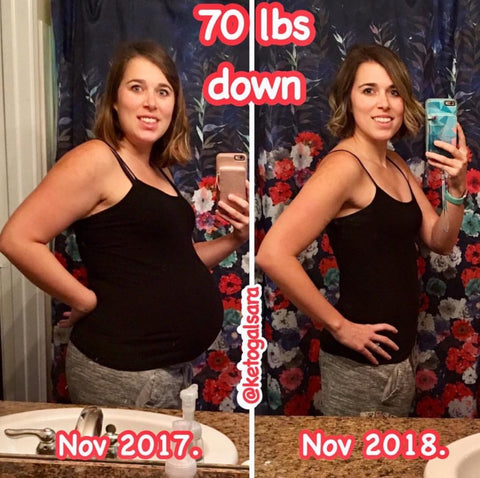 Before and after photos of Sara with a 70 lb difference