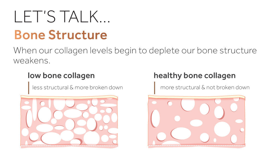 Diagram showing the effect of depleted collagen levels on bone structure