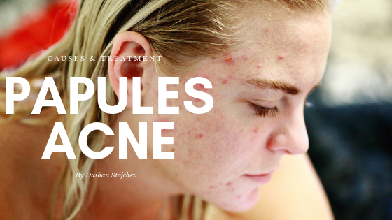 Cure papules How do