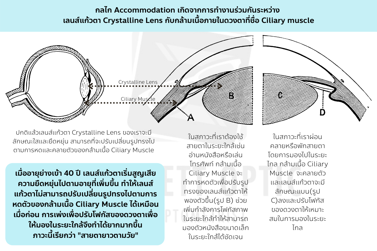 Accommodation ภาวะเพ่ง