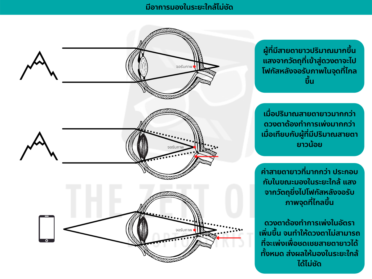 สายตายาว