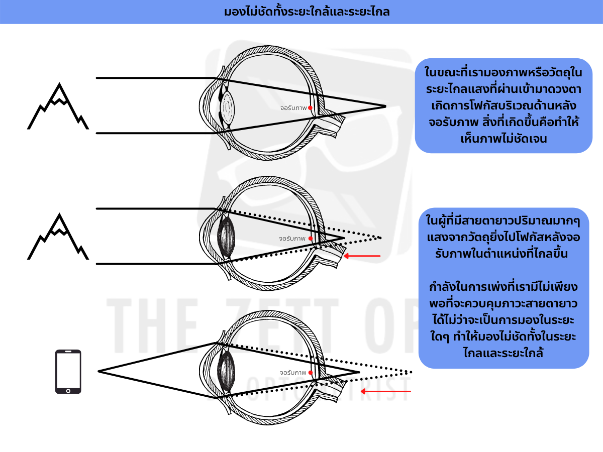 สายตายาว