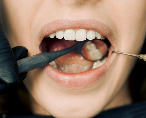 dentist checking patients molar teeth