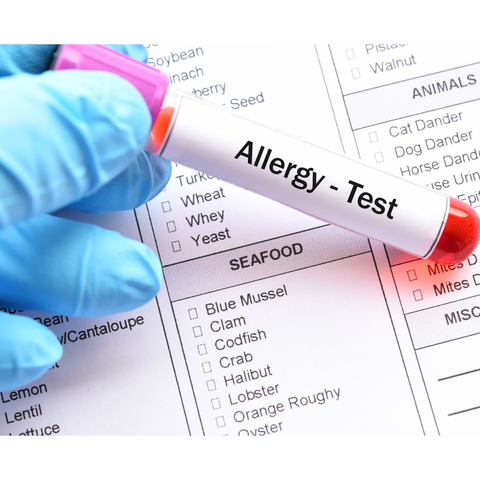 allergy test