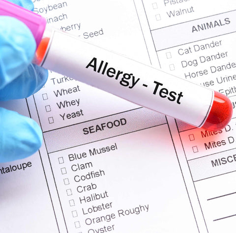 allergy test tube and chart