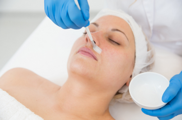 Deep and Medium Chemical Peels work on uneven skin texture