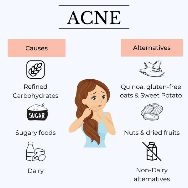 This image shows how food choices can cause acne in teenagers and adults