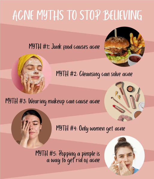 This is an image of Common Acne Myths you need to stop believing on www.sublimelife.in