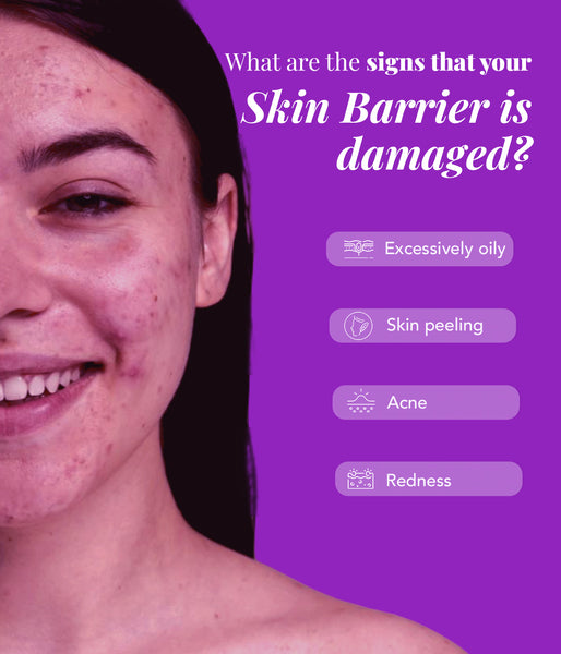 This is an image on What are the signs that your skin barrier is damaged on www.sublimelife.in