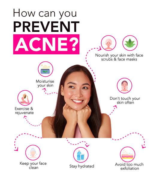 This is an image on How can you prevent acne? on www.sublimelife.in