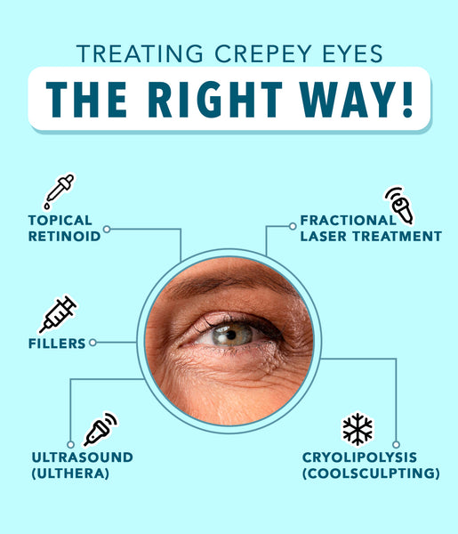 This is an image of treating crepey eyes the right way on www.sublimelife.in