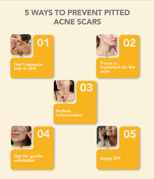 This is an image of 5 ways to prevent pitted acne scars on www.sublimelife.in 