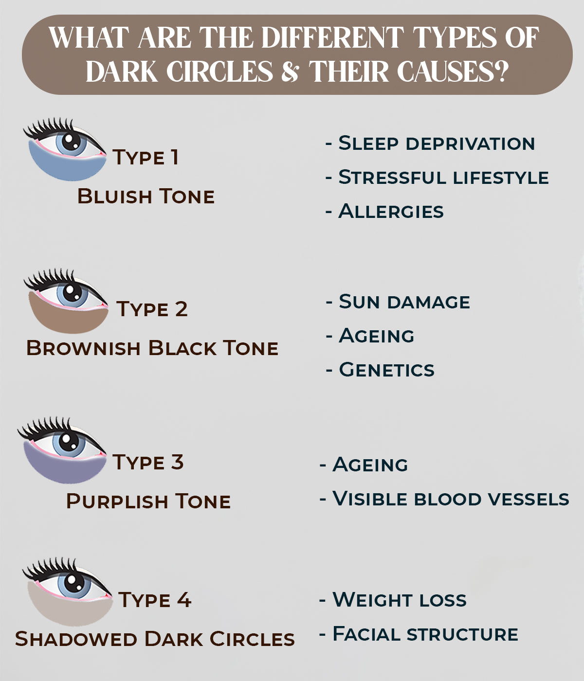 This is an image of what are the different types of dark circles and their causes